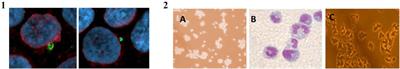 Overview of DISCOVER22 experiment in the framework of INFN-LNGS Cosmic Silence activity: challenges and improvements in underground radiobiology